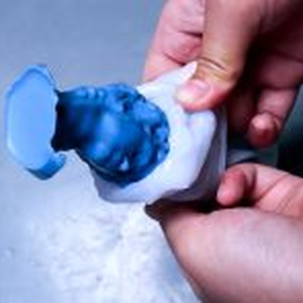 قالب سردیس داوود