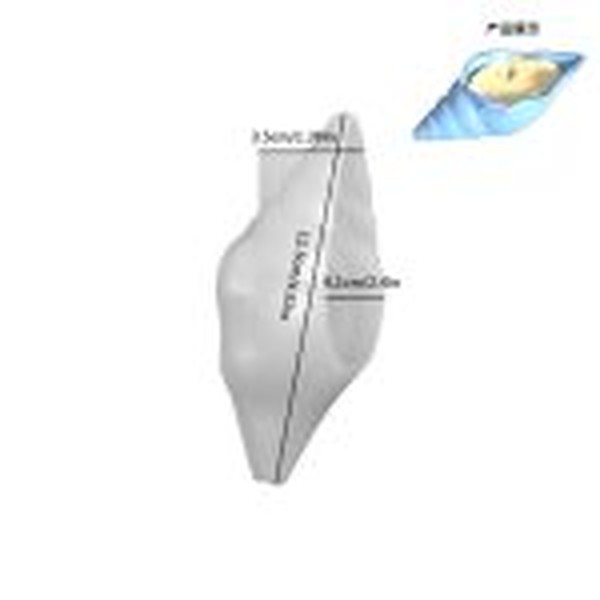 قالب صدف حلزونی